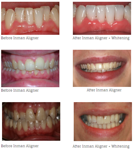 inman Braces in Edinburgh